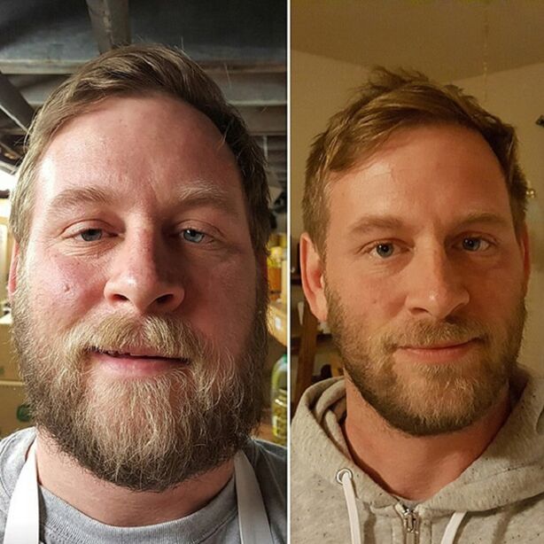 personas izskats pirms un pēc atteikšanās no alkohola
